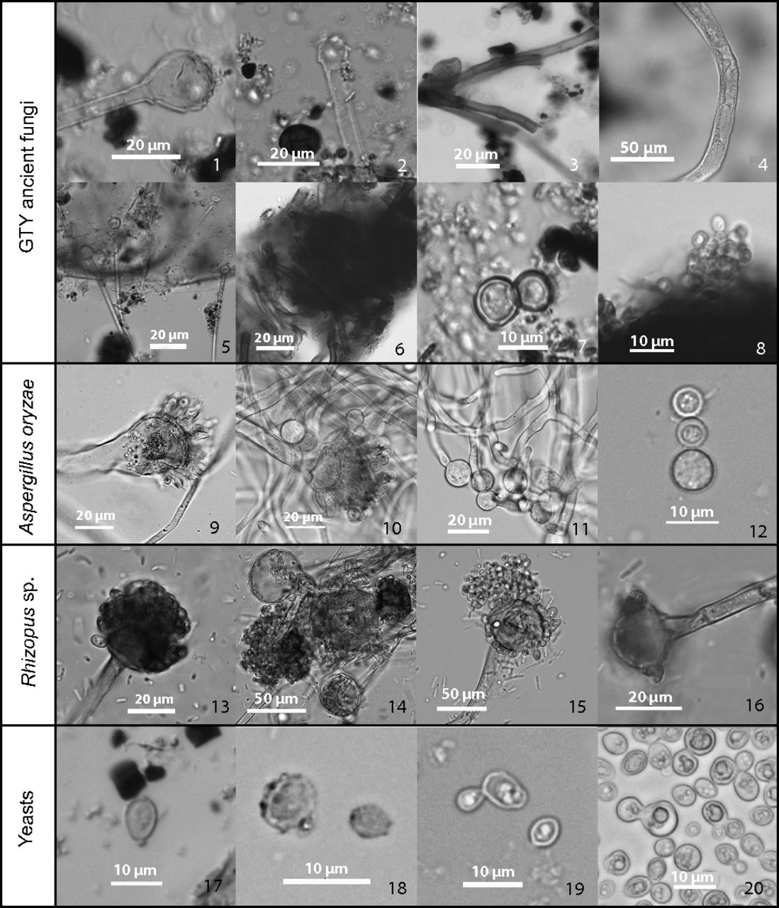 Several microscope images of fungal spores and yeast cells.
