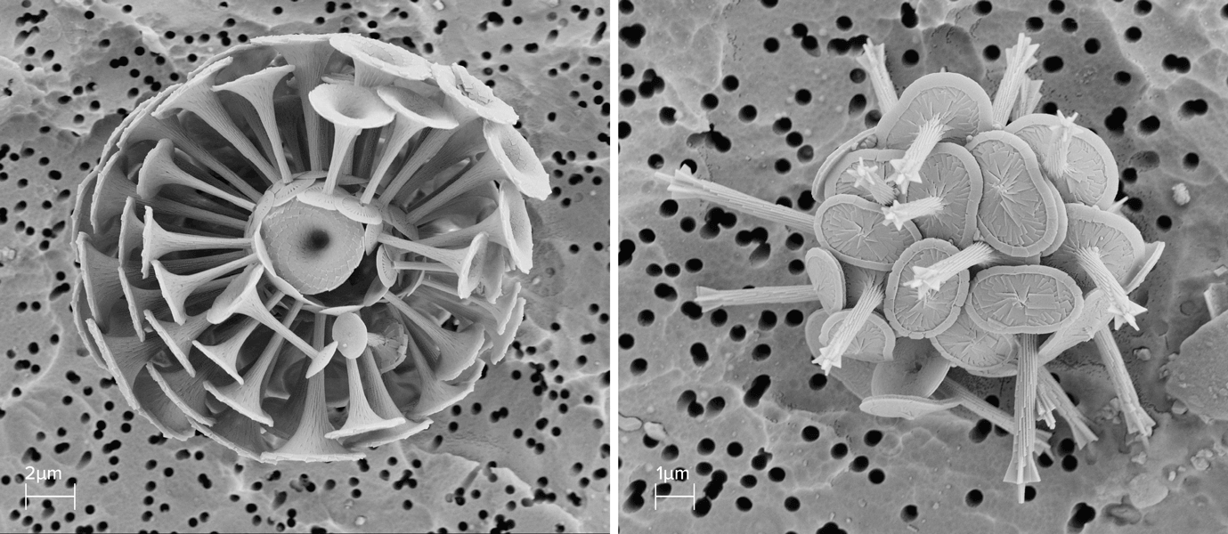 Scanning electron microscope images of two different kinds of coccolithophore.