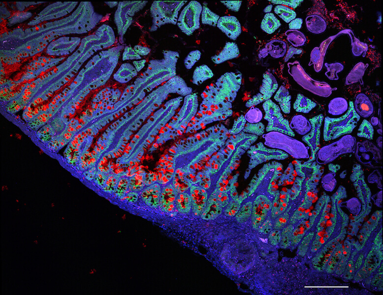 A stained cross section of the lining of the small intestine.