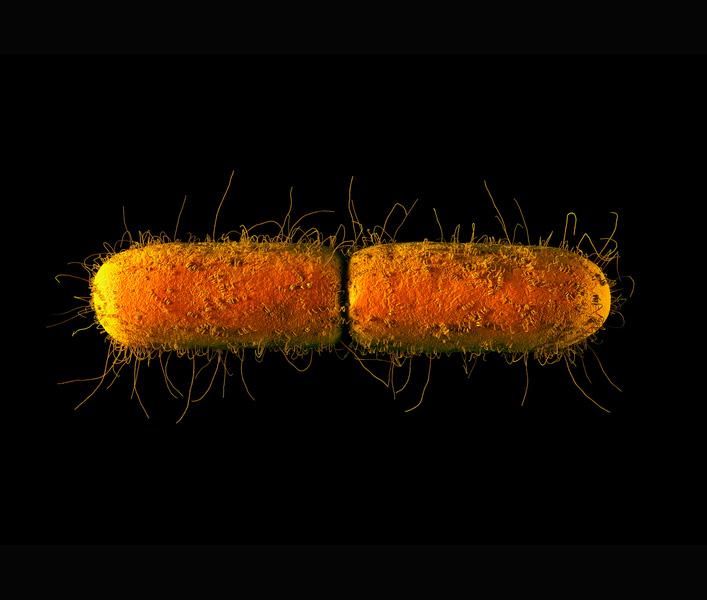A picture of E. coli.
