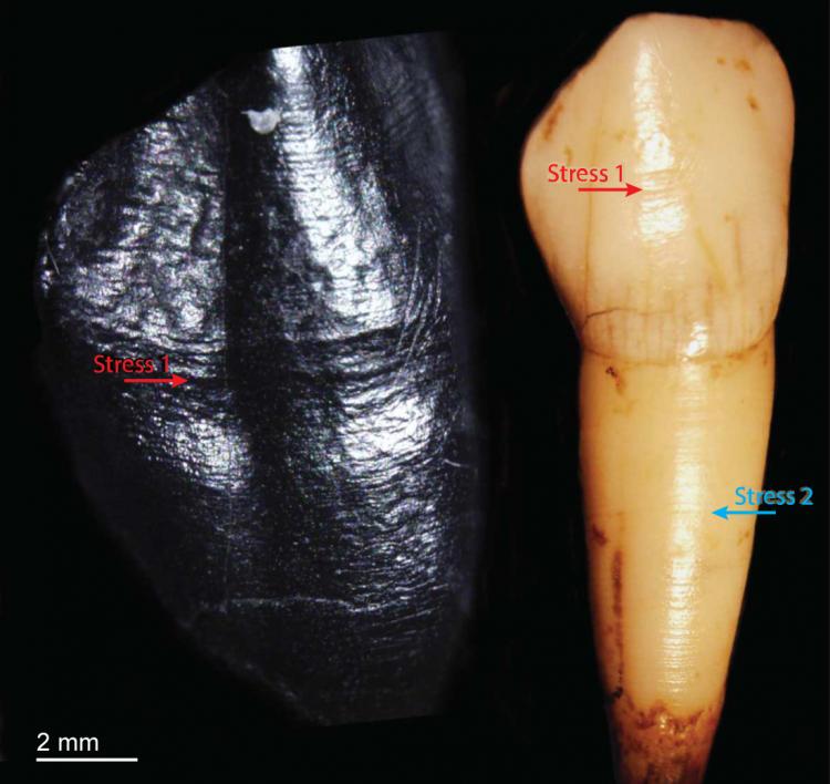 Neanderthal canine tooth shows irregular growth
