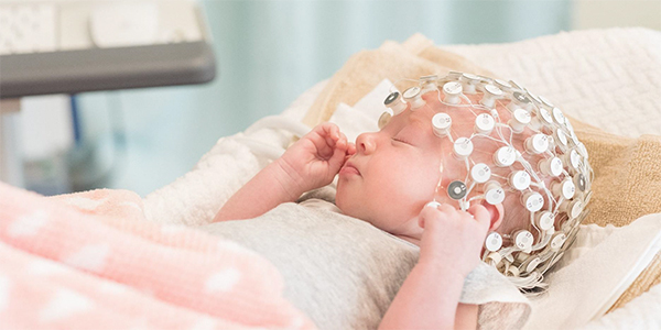 Photo shows a young sleeping infant wearing an array of electrodes on its head. The electrodes record brain activity while the baby sleeps.