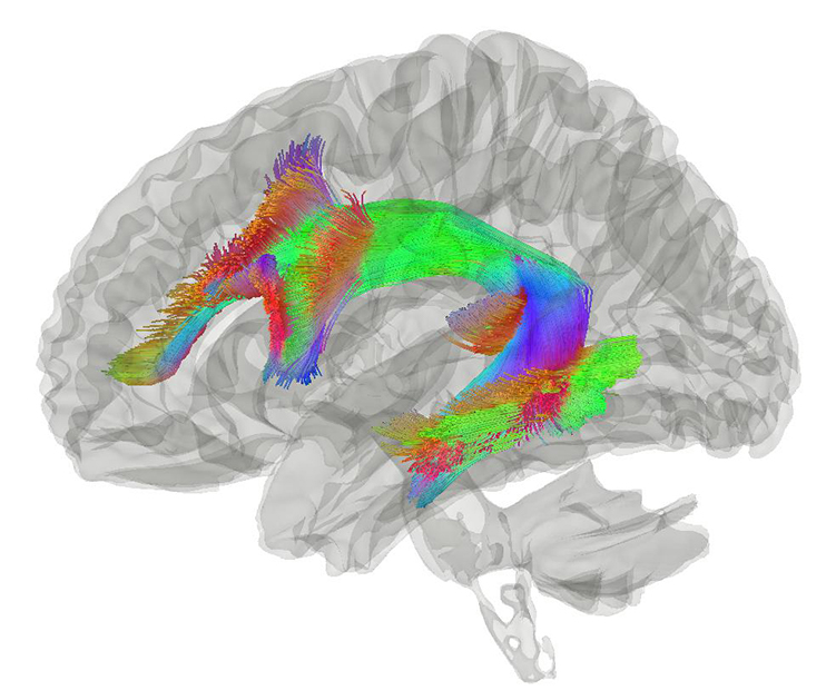  An image of a brain. Certain parts of it are colored green, red and blue.