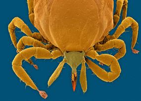 Lyme and other tick-borne diseases are on the rise. But why?