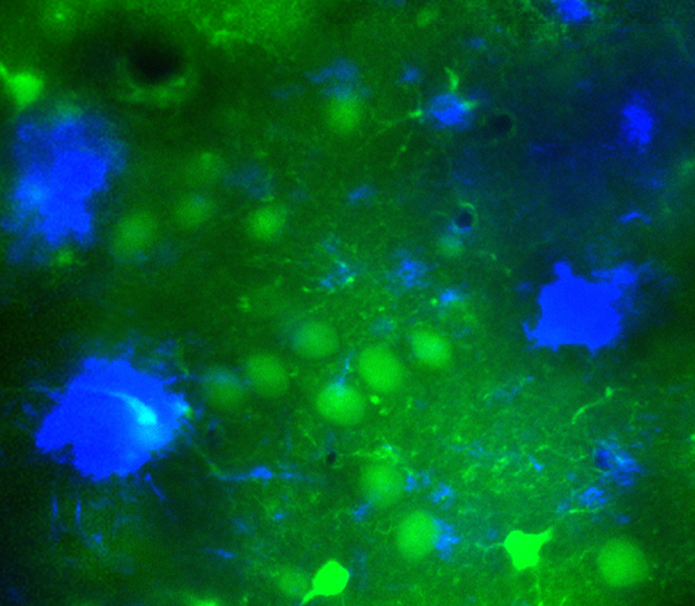 A photo shows cellular activity in the brain of a live mouse. In this mouse model of Alzheimer’s disease, a new imaging technique shows amyloid-β plaques and nearby nerve cells. Nerve cells near the plaques can become hyperactive, meddling with communication between different areas of the brain. This hyperactivity led to the testing of an epilepsy drug to treat Alzheimer’s in the mouse model. The drug is now being tested in clinical trials with Alzheimer’s patients.