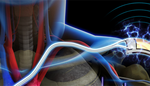 Self-powered pacemaker