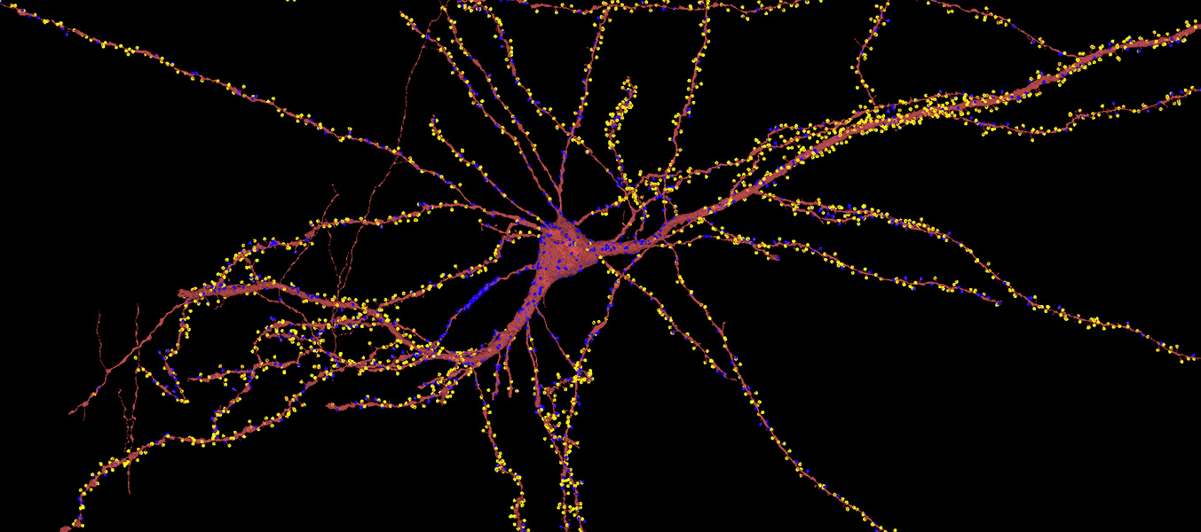 Microscopic, false-colored image shows the many threadlike tendrils of a neuron branching out from a central cellular core. The cell is awash in yellow spots with some areas of blue, all of which reveal connections to other neurons.