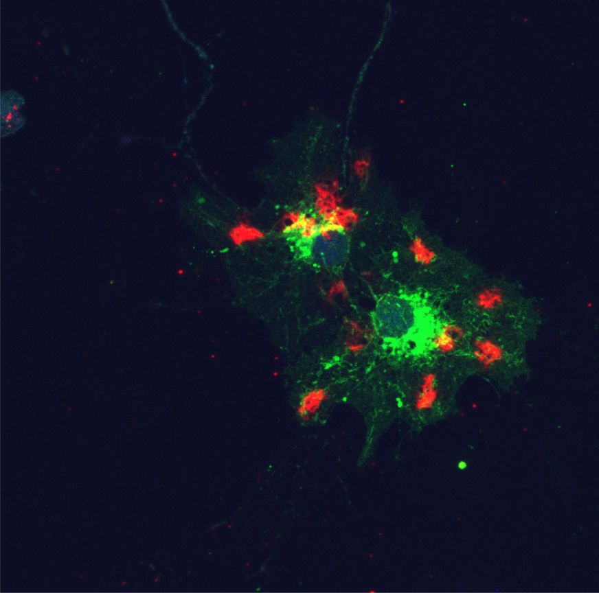 Image shows a microscope image of connective tissue from a mouse that has taken up extracellular vesicles derived from human plasma; the cells’ nuclei and skeletal components are also visible.