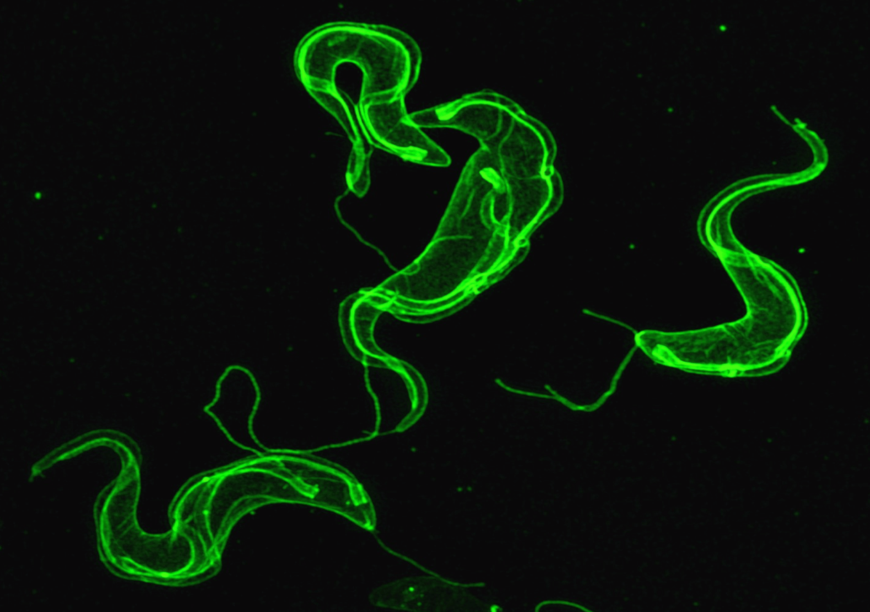 Image shows a super-resolution microscope photograph of a group of trypanosomes, the parasites that cause African sleeping sickness.