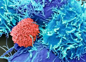 Arming immune foot soldiers against cancer 