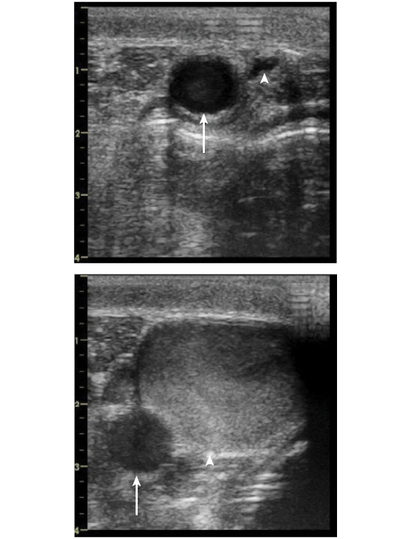 Ultrasound images of a cross-section of a giraffe’s neck. One shows the normal, head-up position in which the jugular vein is small. The other shows that when the head is down, the jugular vein swells dramatically, allowing it to store blood.