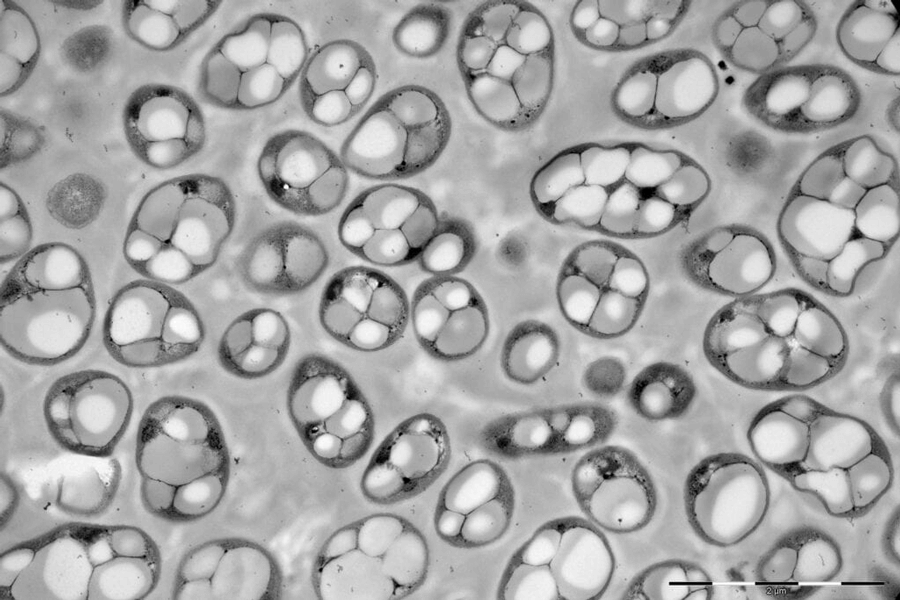 Electron micrograph image shows several bacteria containing large white blobs of the natural polymer PHA.