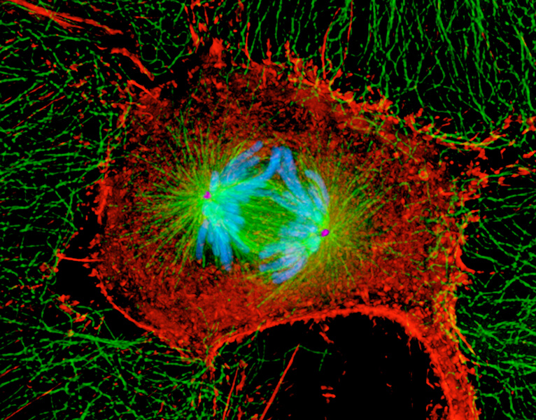 A dividing mammalian cell. Chromosomes (colored blue) are being dragged to each end of the cell by a mesh of microtubules (green). Centrosomes that organize the microtubules can be seen at each pole of the cell, colored pink.