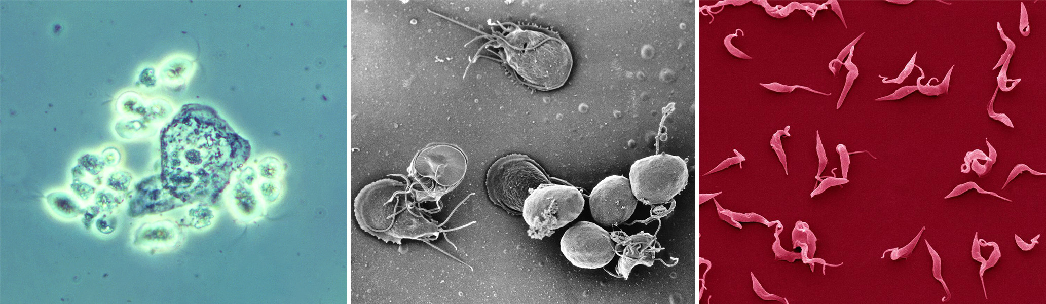 Photos of three primitive, single-celled eukaryotes.