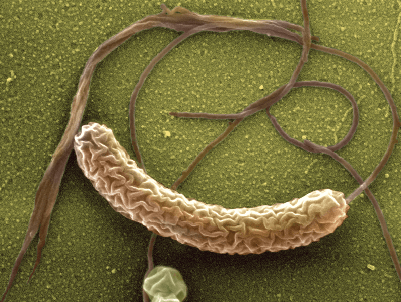 A colored scanning electron micrograph shows Vibrio cholerae, a rod-shaped bacterium with a single long hair-like flagellum that it uses to propel itself through the water. Challenge trials with this bacterium, which cases cholera, led to the development of Vaxchora, the first FDA-approved vaccine for the disease.