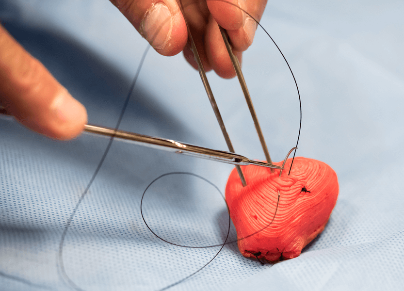Photograph of a 3-D-printed prostate that can be equipped with pressure sensors, allowing surgeons to practice on material with a lifelike feel as they rehearse procedures.