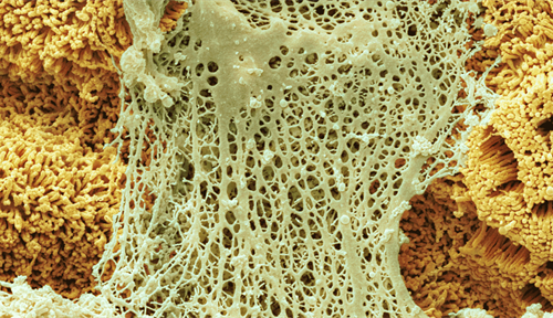 Colored scanning electron micrograph of mucin secretions in the small intestine.