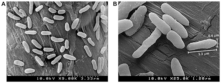 SEM of rod-shaped bacteria