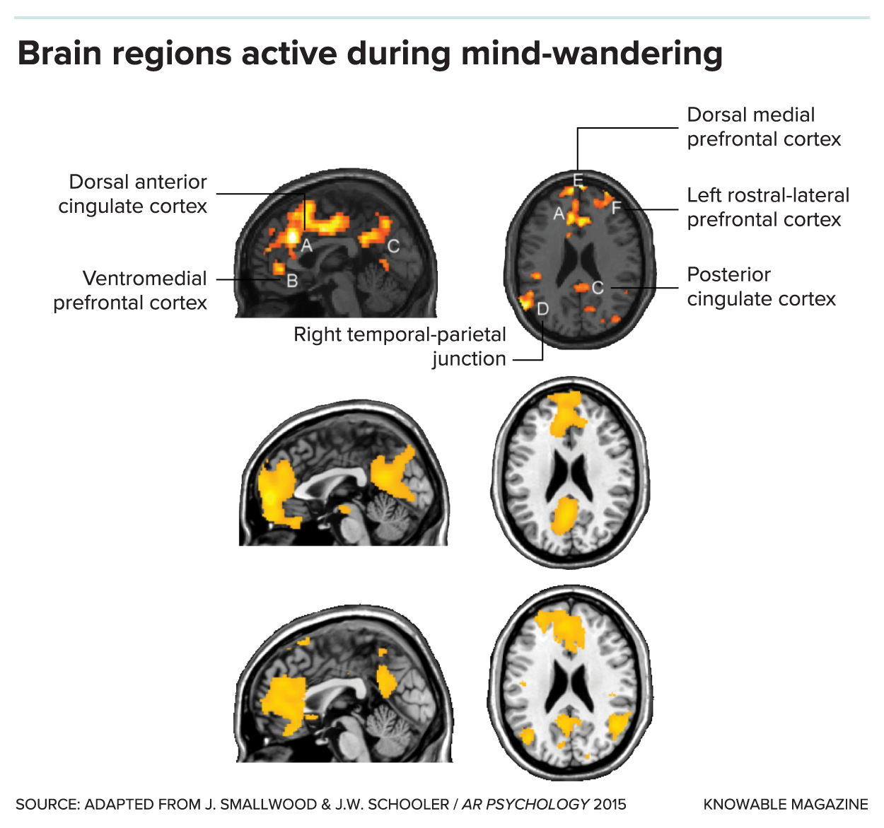 Six grey fMRI images of the brain with active spots lit up in red and yellow.