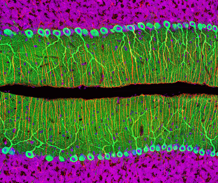 A colored light micrograph shows two bands of green flask-like Purkinje cells, whose necks extend in straight lines.