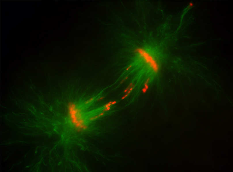A microscopic image of a dividing cell with green microtubules forming a mesh stretching to each pole. A cluster of orange chromosomes are near each pole. But there are orange blobs lagging behind in the center of the cell.