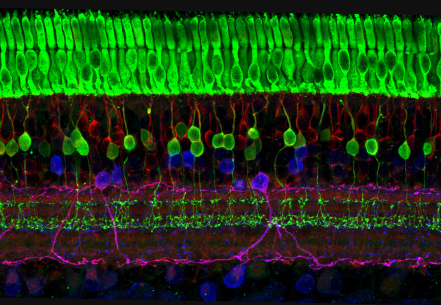 Micrograph shows orderly layers of distinct types of nerve cells within a healthy retina.