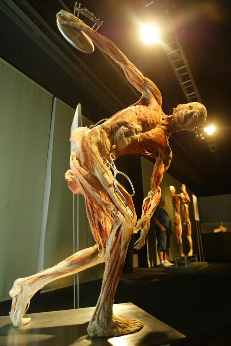 Photograph of a preserved and dissected corpse from China’s Bodies: The Exhibition. Critics say that some bodies may be executed prisoners. Whether or not that is true, Stroud notes that it is not aga