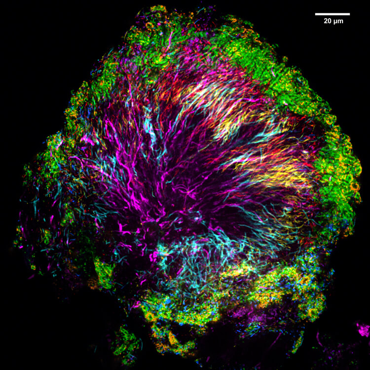 Fluorescent microscopic image shows the organization of bacteria living within dental plaque.