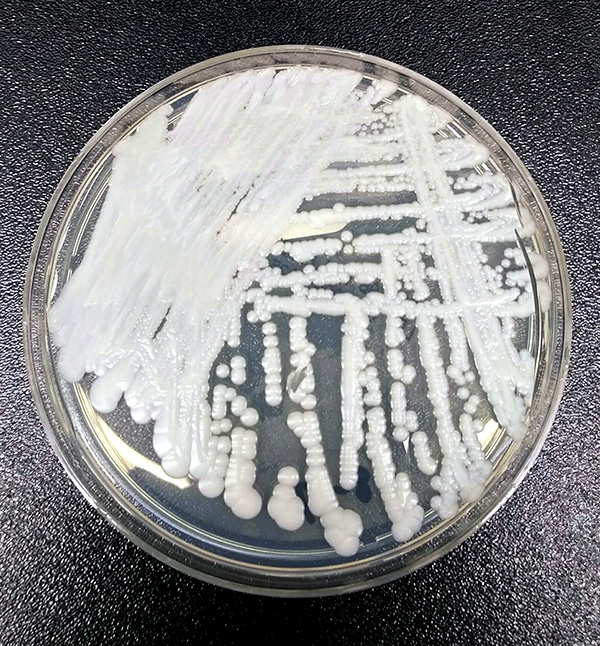 Placa de Petri con colonias de hongos.