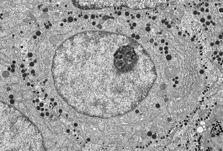 Micrograph of part of a cell showing many of its internal structures, some bounded by membranes and others not.