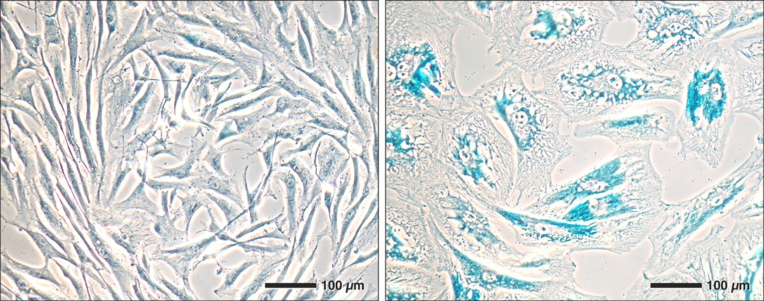 On the left are small, transparent young cells stained with a light blue. On the right are larger, less regular, older cells stained a more intense blue.
