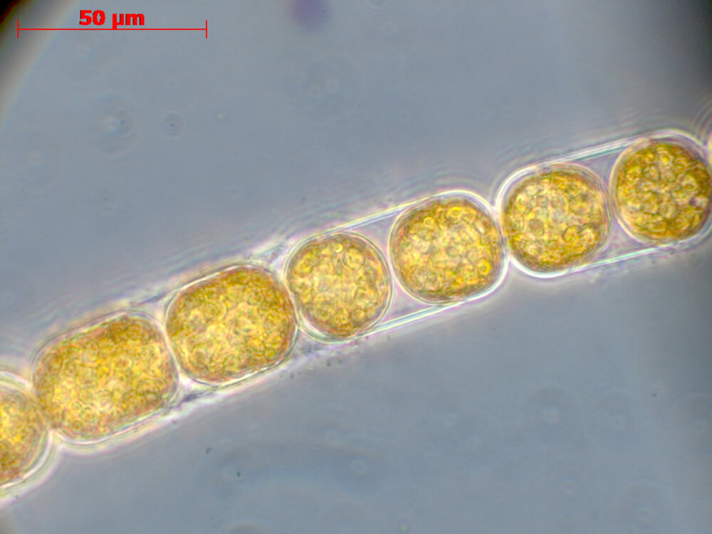 A magnified photo of the alga M. arctica in a chain formation