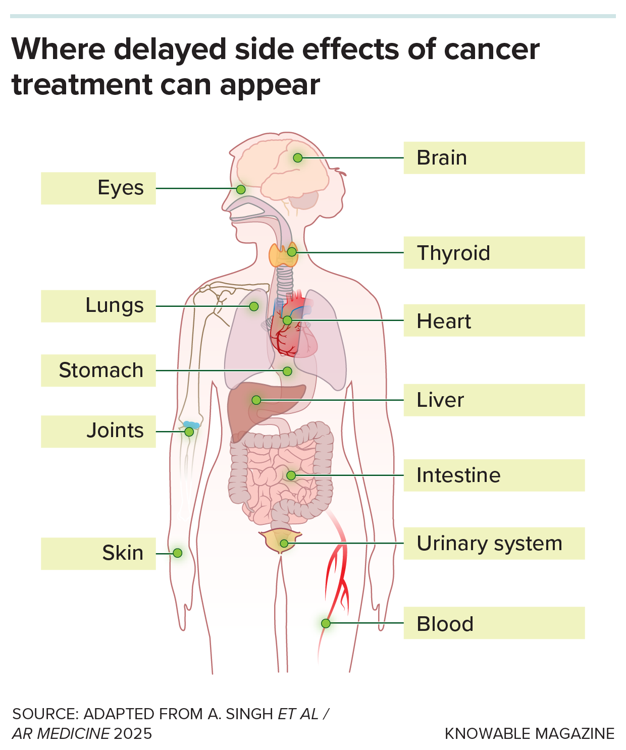 Drawing of human body showing where delayed side effects of cancer treatment can appear