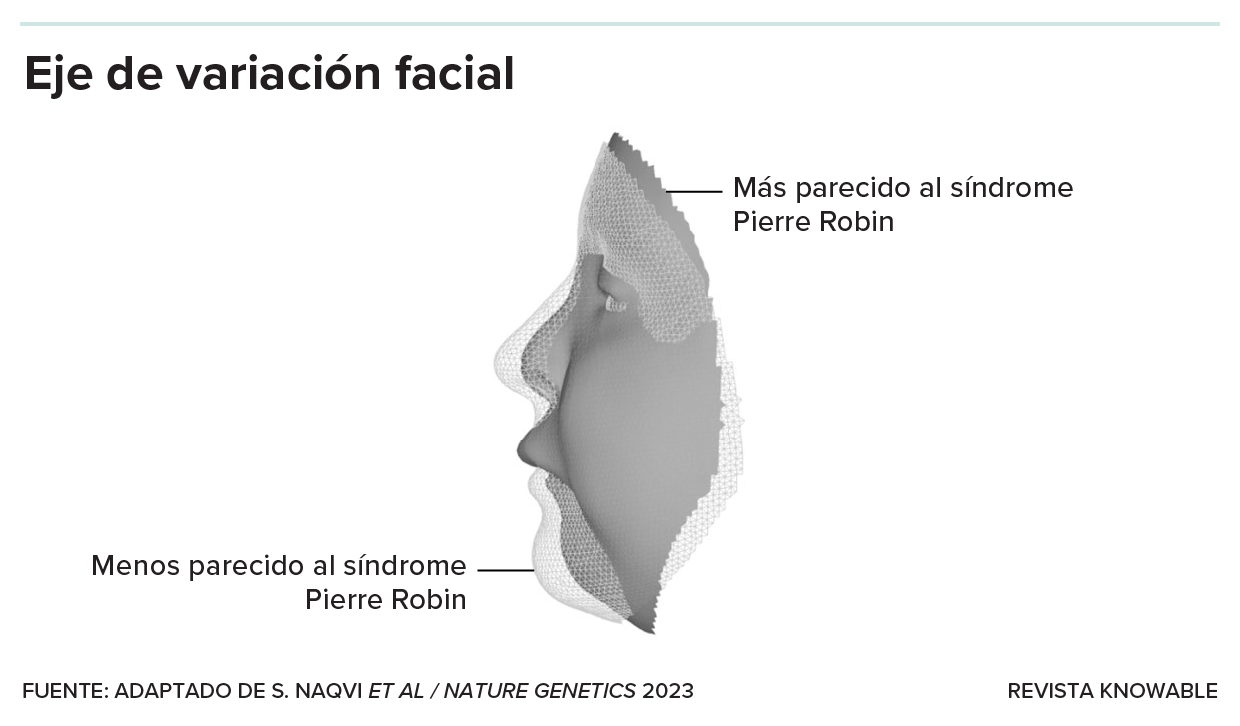 Una vista de perfil superpone dos caras, una con nariz más larga y mentón más pronunciado, y la otra con cara plana, labio superior alargado y barbilla retraída.