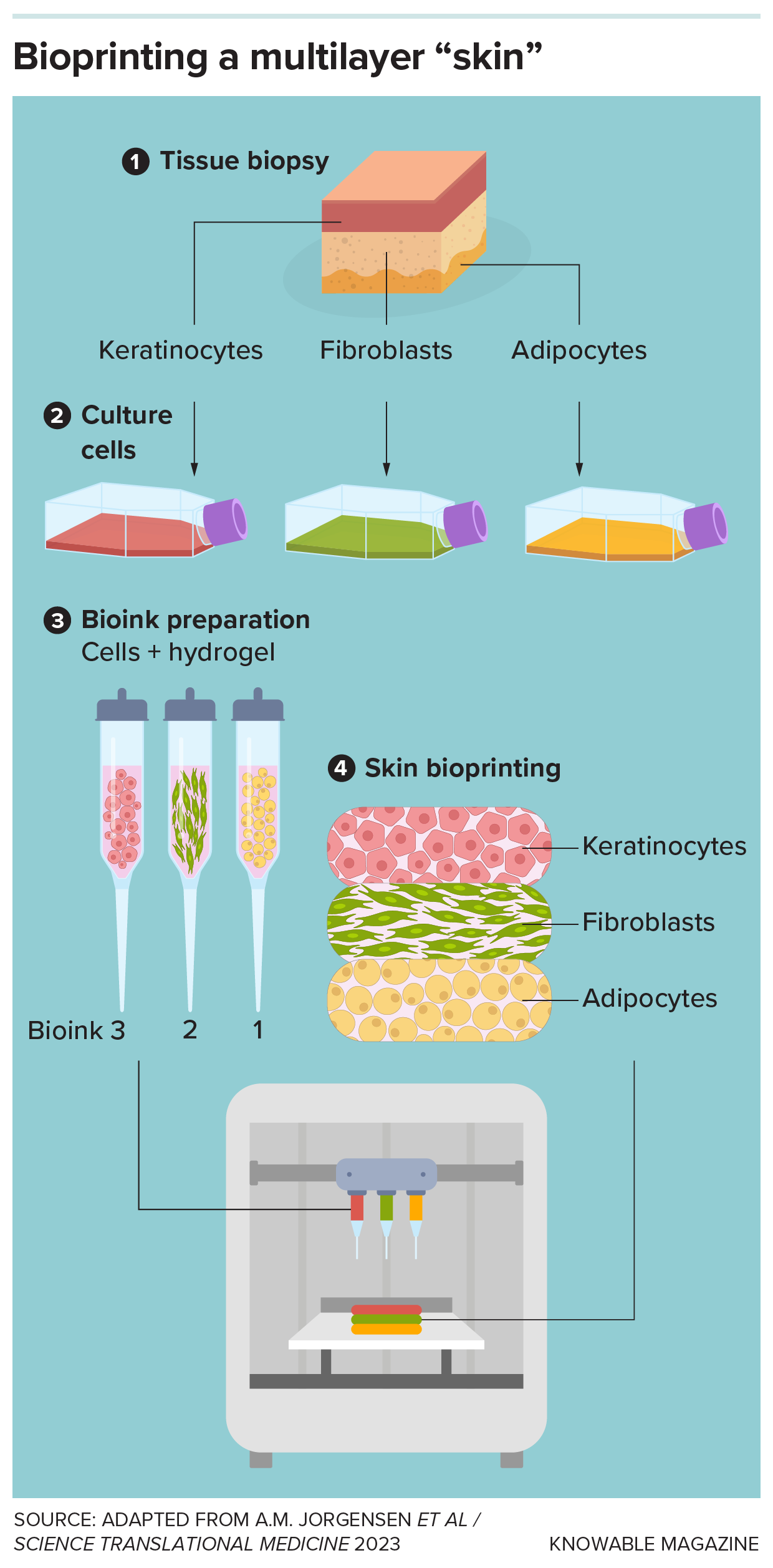 Graphic shows the steps to print a three-layer skin