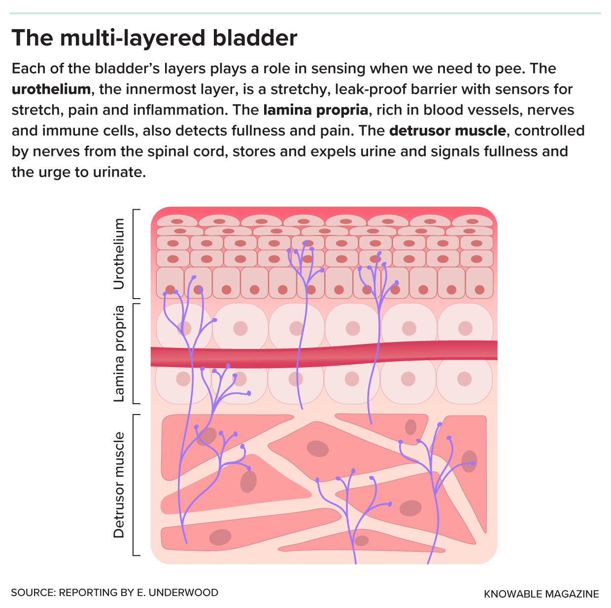 The bladder wall’s three main layers. Shown top to bottom from the inside out: the urothelium, lamina propria and detrusor muscle.