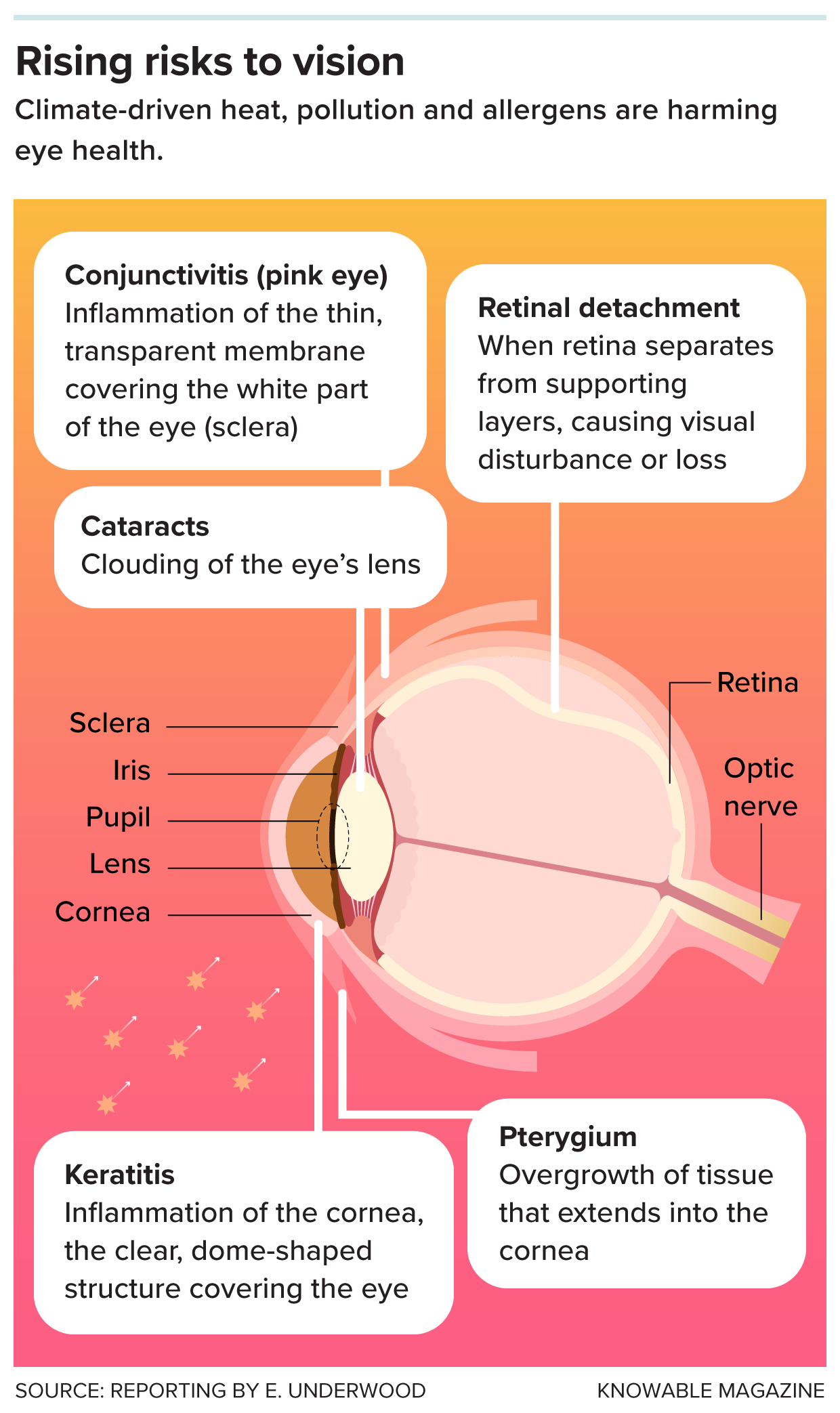 How climate-driven heat, pollution, and allergens affect the eye Side view diagram of an eye with labeled anatomy, alongside a list of eye conditions linked to climate-driven heat, pollution, and allergens