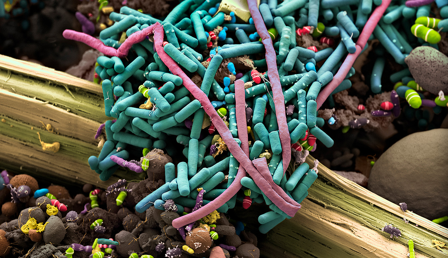 Colorized scanning electron microscope image of excrement shows a pale green piece of plant fiber covered by tiny microbes colored teal, purple, red, green, brown and more. 