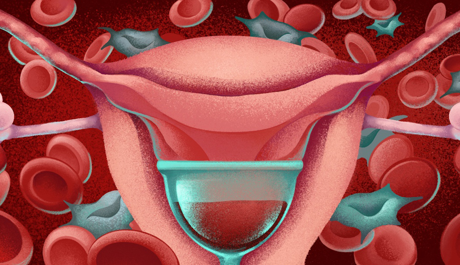 Artist’s rendering of uterus and stem cells in menstrual blood