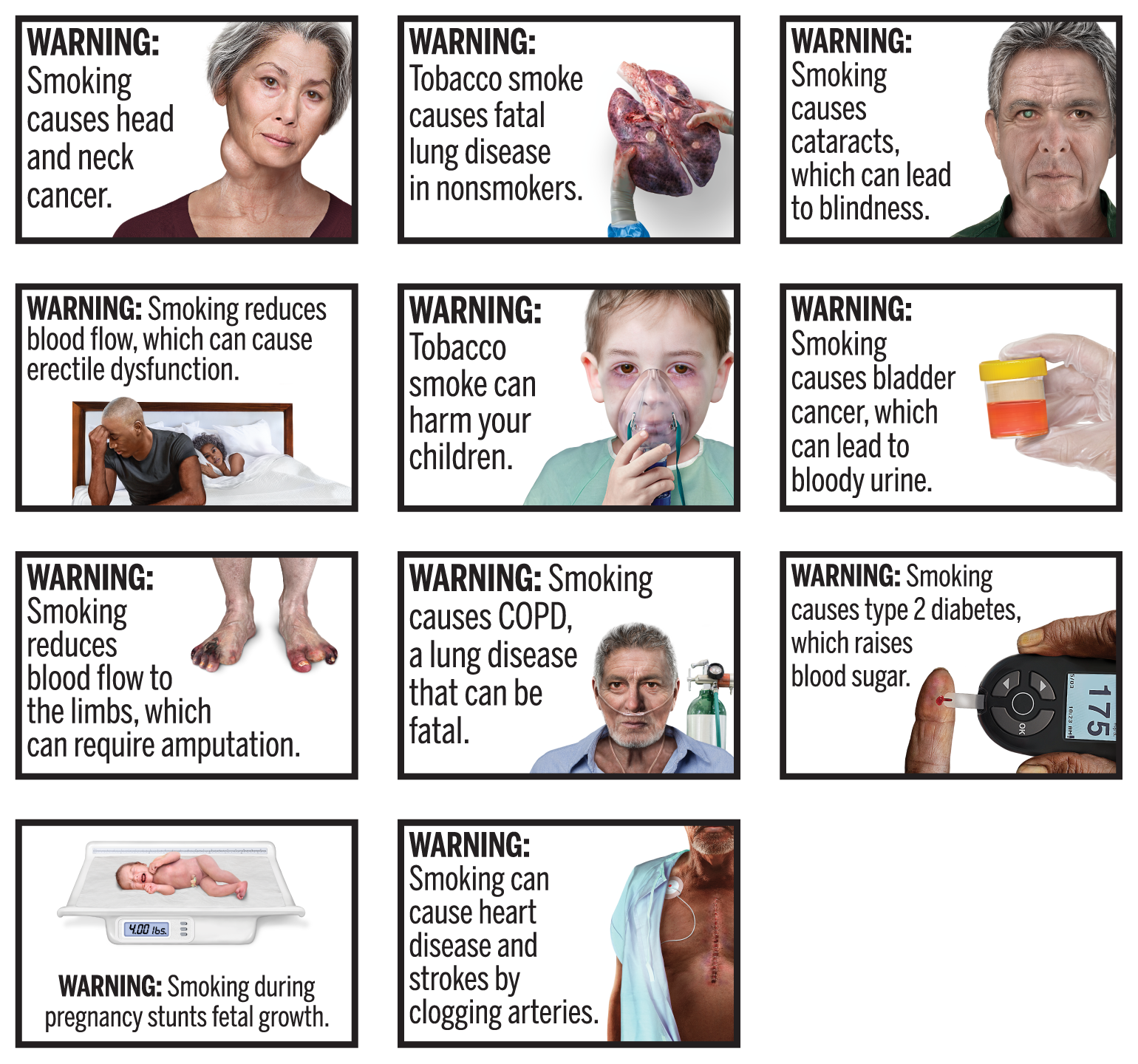 A grid of eleven graphic images warning about the harms of smoking show diseased lungs, a baby in incubator, gangrenous toes, bloody urine and a neck tumor, among other things.