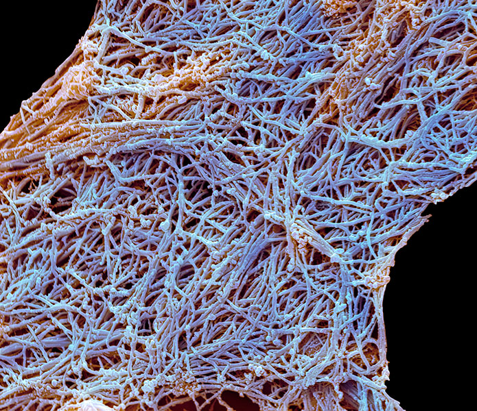 A tangled mass of fibers