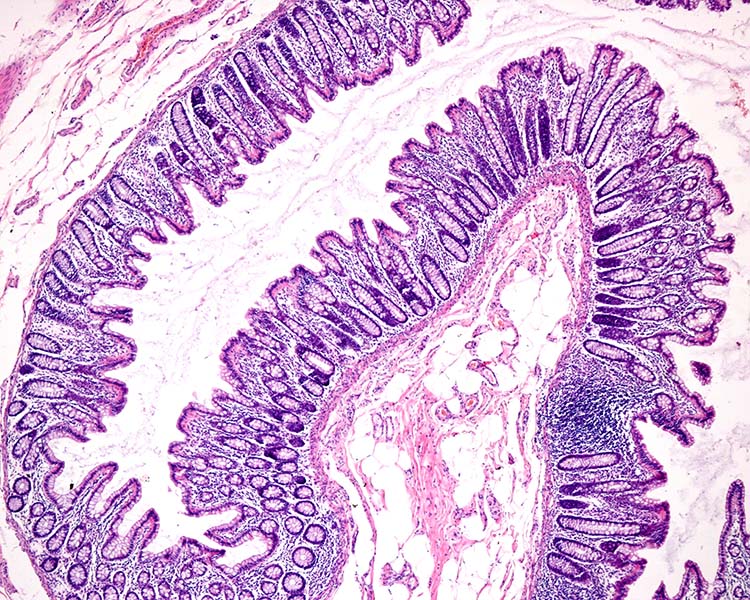 A pink-and-purple microscope image of the interior surface of the colon.