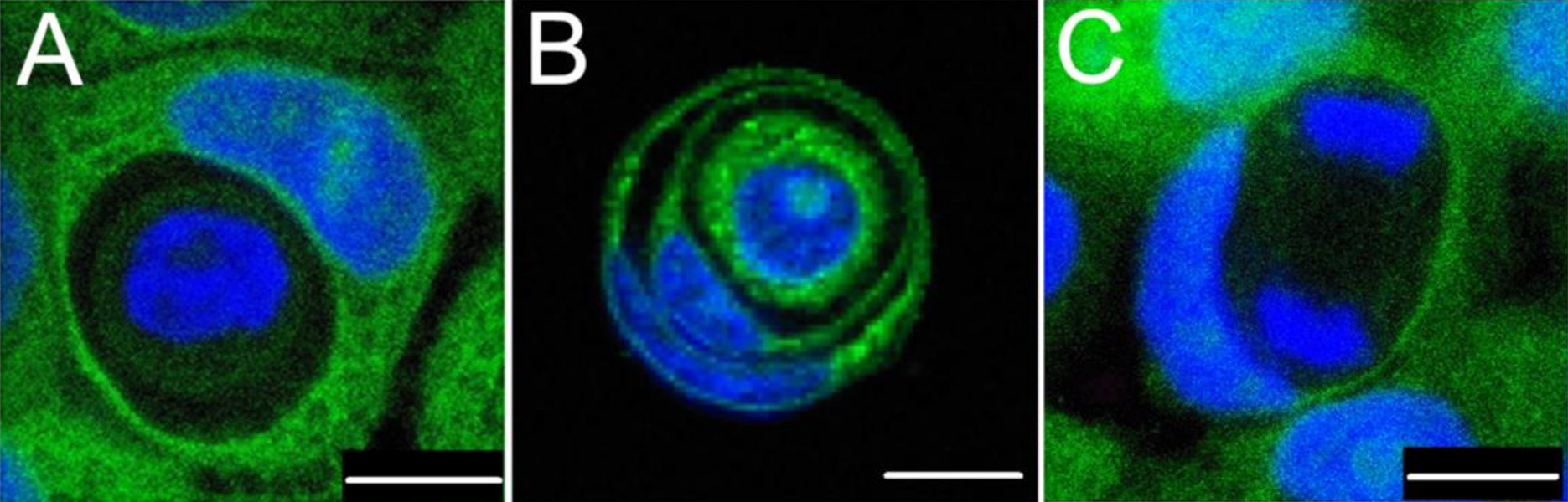 Three microscope images show cells within other cells.