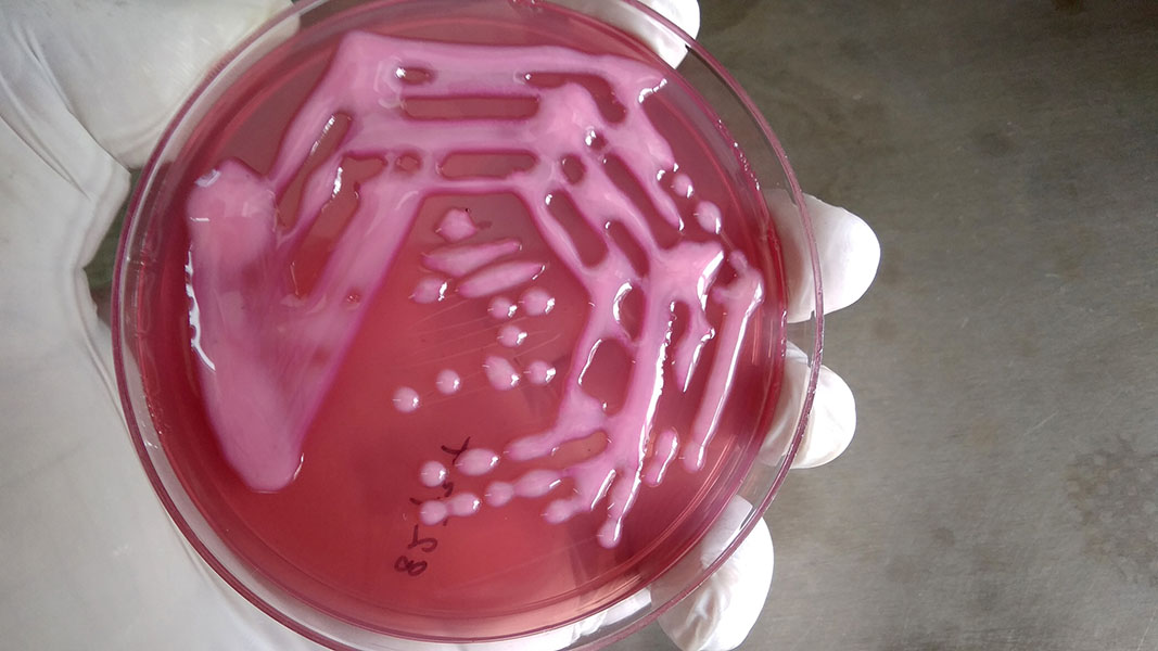 Klebsiella culture A gloved hand holds a Petri dish streaked with pink bacterial colonies.