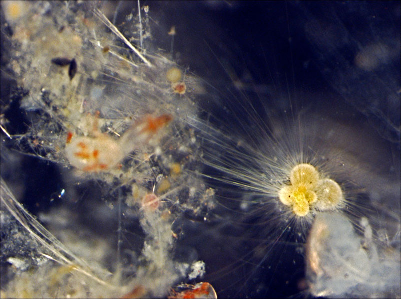 Globigerinella calida A photograph of a living foraminiferan shows its shape — it looks like a series of globe-like structures stuck together. Also visible are the thin tentacle-like structures that extrude from holes in its shell quite a distance.