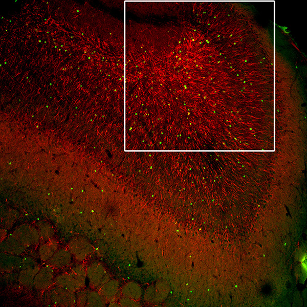 Microscopic image of neurons of the olfactory bulb.