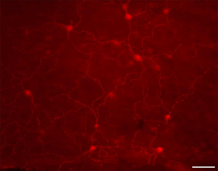 Microscope image of mouse retina tissue shows a field of red with some blobs glowing more brightly.
