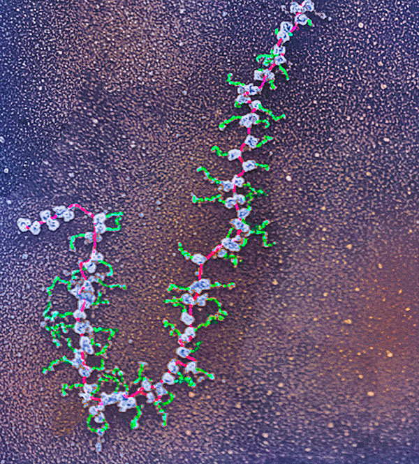 Colorized transmission electron microscopy image shows a long loop of red covered with blue and green blobs. The blue blobs are ribosomes, while the green blobs are proteins being built.