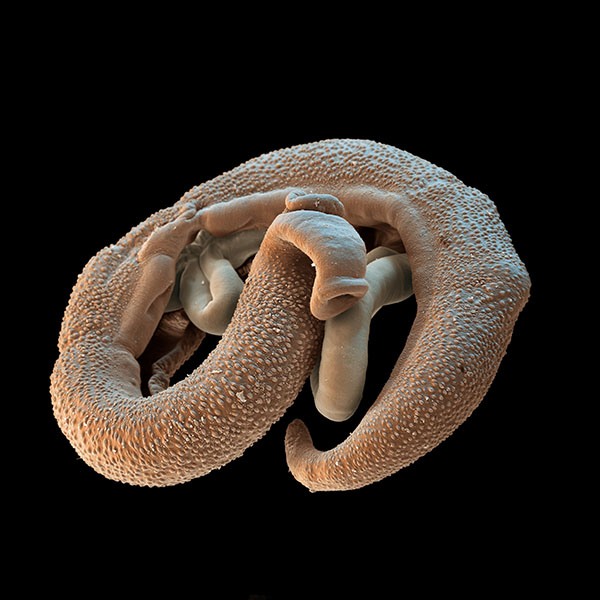 Blood flukes A close-up of two worms twined together.