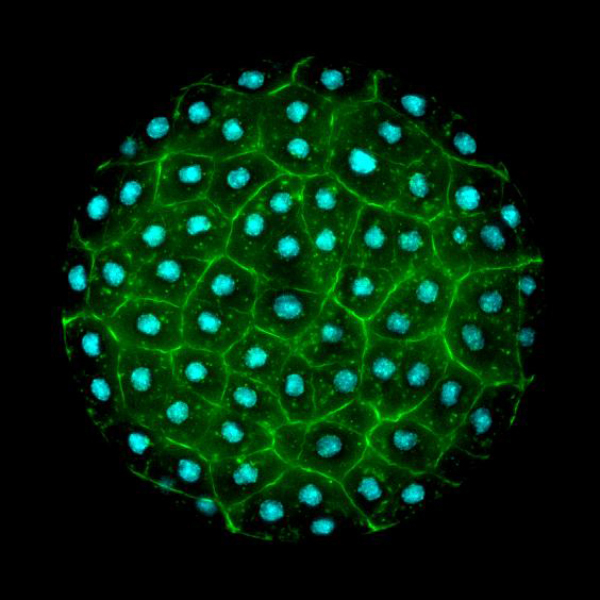 A micrograph shows a ball of cells clumped together, with a blue dye staining their nuclei.